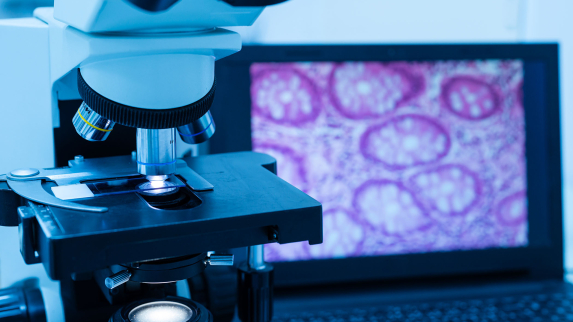 Rutgers Develops New Tool for Examining Cancer Genomic Data that Could Improve Treatment.