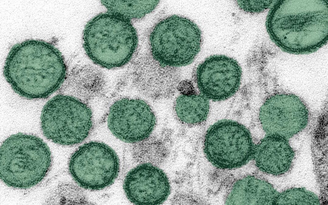 Local infectious disease doctor says Hantavirus risk to public remains low.